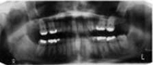 Perfect Smile panoramic radiograph